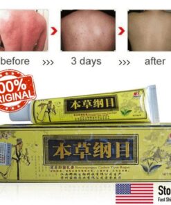 Natūralus žolelių kremas pažengusiam psoriazės ir egzemos gydymui