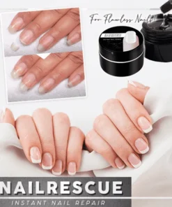 NailRescue momentinis nagų taisymas