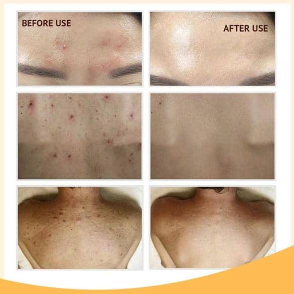 Retinol C+ šviesinantis serumo rinkinys - Image 10