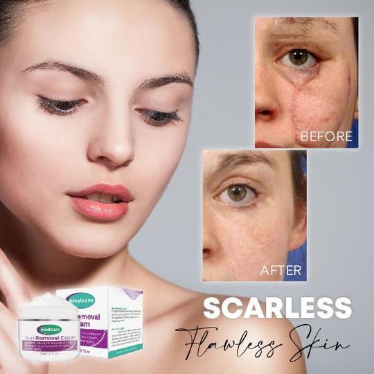 Medease Skin Rebound kremas - Image 2