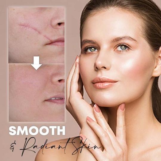 Medease Skin Rebound kremas - Image 3