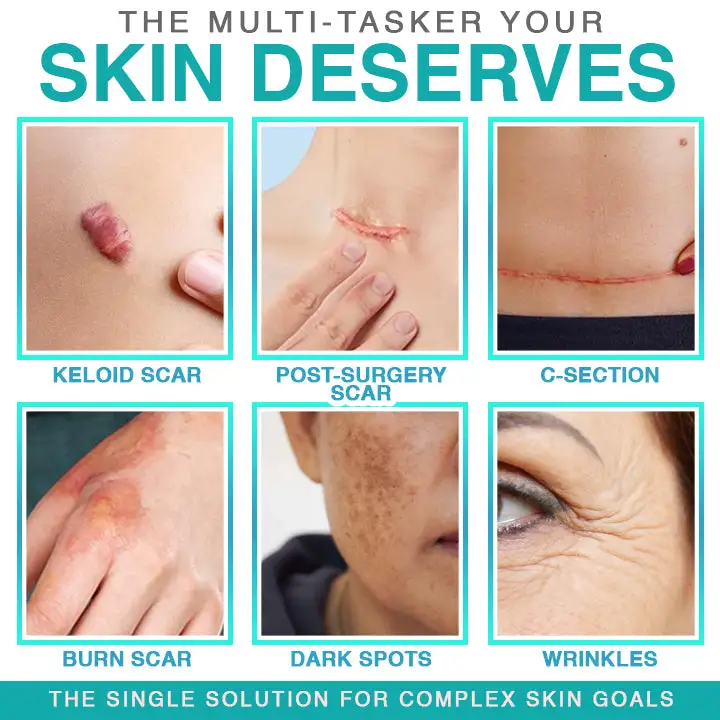 𝗖𝗮𝗿𝗲𝗕𝗿𝗲𝗲𝘇𝗲® 3 viename mikroadatos priežiūros pleistras - Image 2