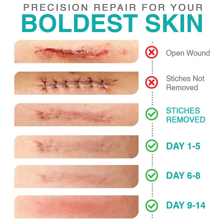 𝗖𝗮𝗿𝗲𝗕𝗿𝗲𝗲𝘇𝗲® 3 viename mikroadatos priežiūros pleistras - Image 4