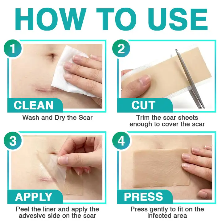 𝗖𝗮𝗿𝗲𝗕𝗿𝗲𝗲𝘇𝗲® 3 viename mikroadatos priežiūros pleistras - Image 7