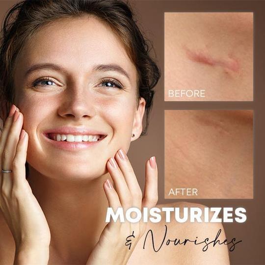 Medease Skin Rebound kremas - Image 4