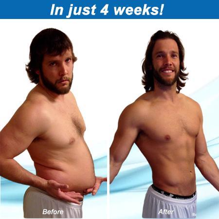 Susitraukiantys magnetiniai liekninantys auskarai - Image 4