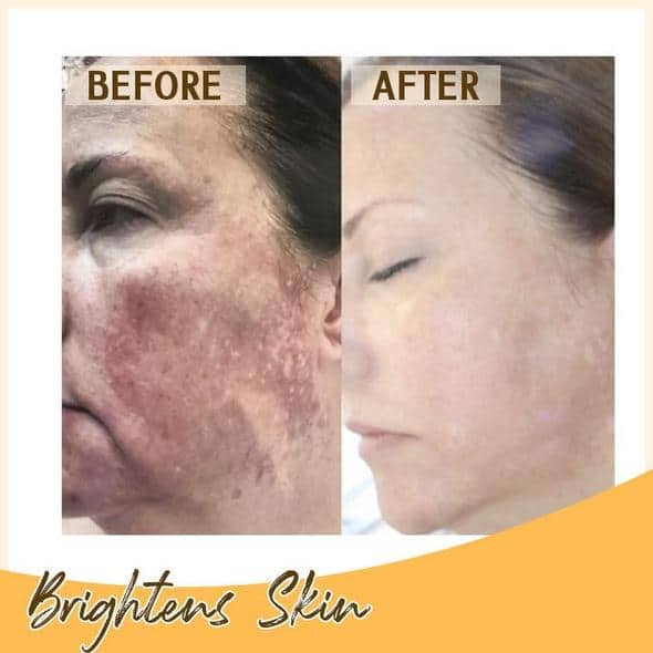 Retinol C+ šviesinantis serumo rinkinys - Image 6