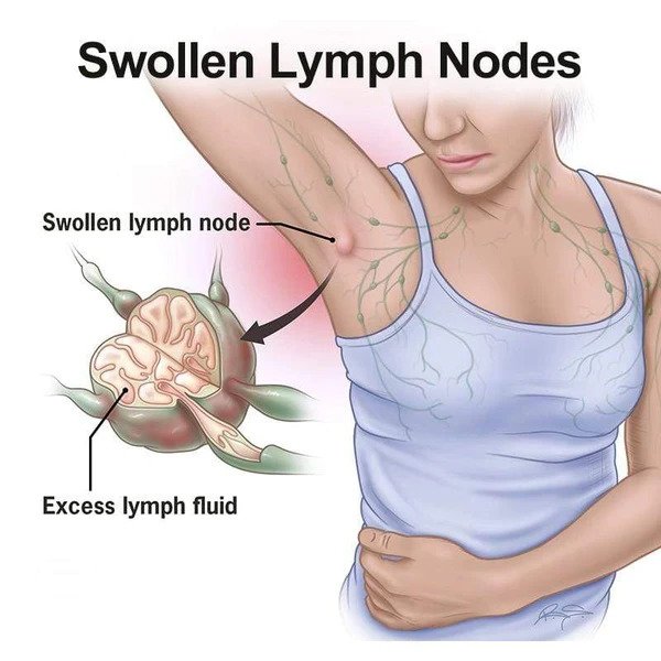 Biolita Limphatic Care Pleistras (5/10/20 vnt.) - Image 6