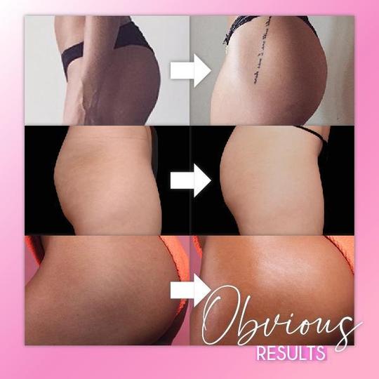 Bootie formuojantis pakeliamas pleistras - Image 6