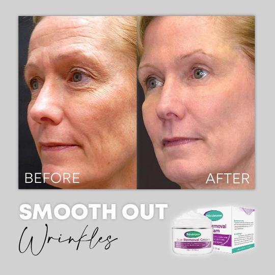 Medease Skin Rebound kremas - Image 7