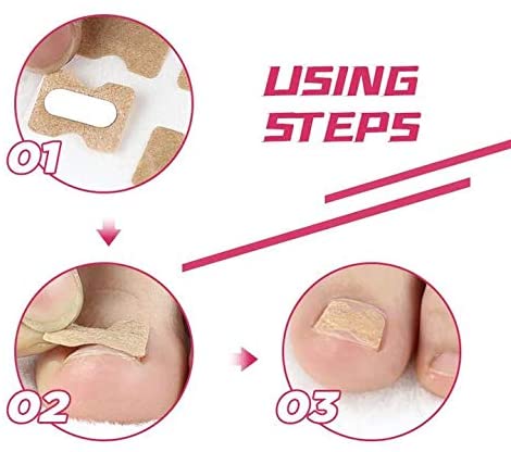 Įaugusio nago koregavimo pleistras - Image 6