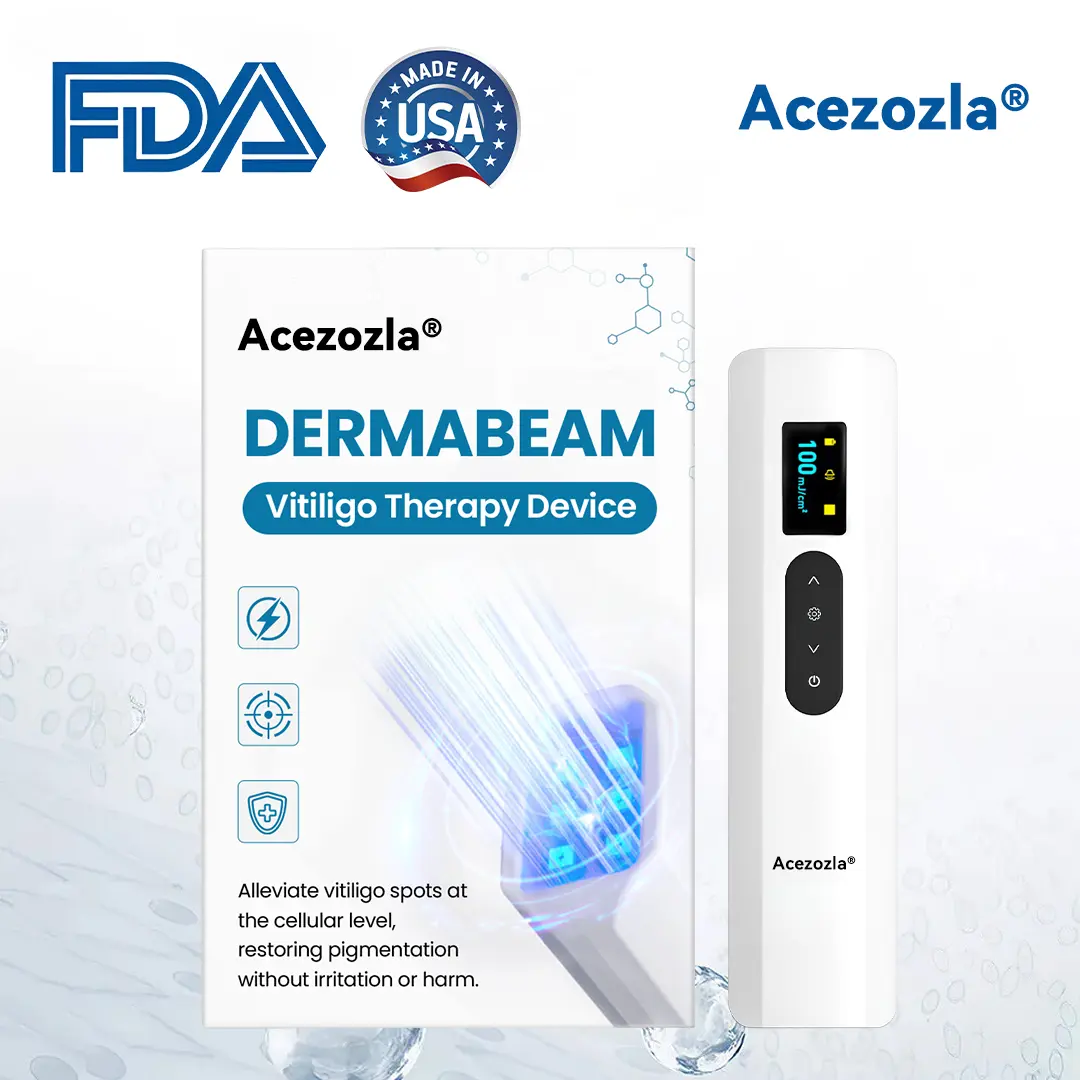 Acezozla® DermaBeam vitiligo terapijos prietaisas