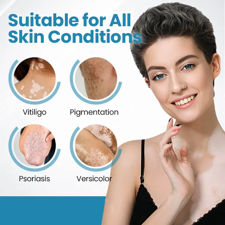 Acezozla® DermaBeam vitiligo terapijos prietaisas - Image 2