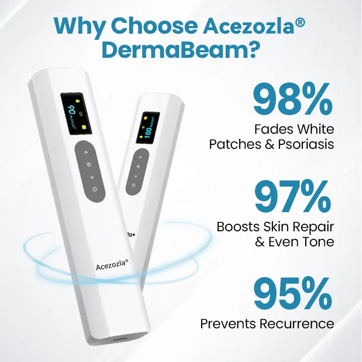 Acezozla® DermaBeam vitiligo terapijos prietaisas - Image 6