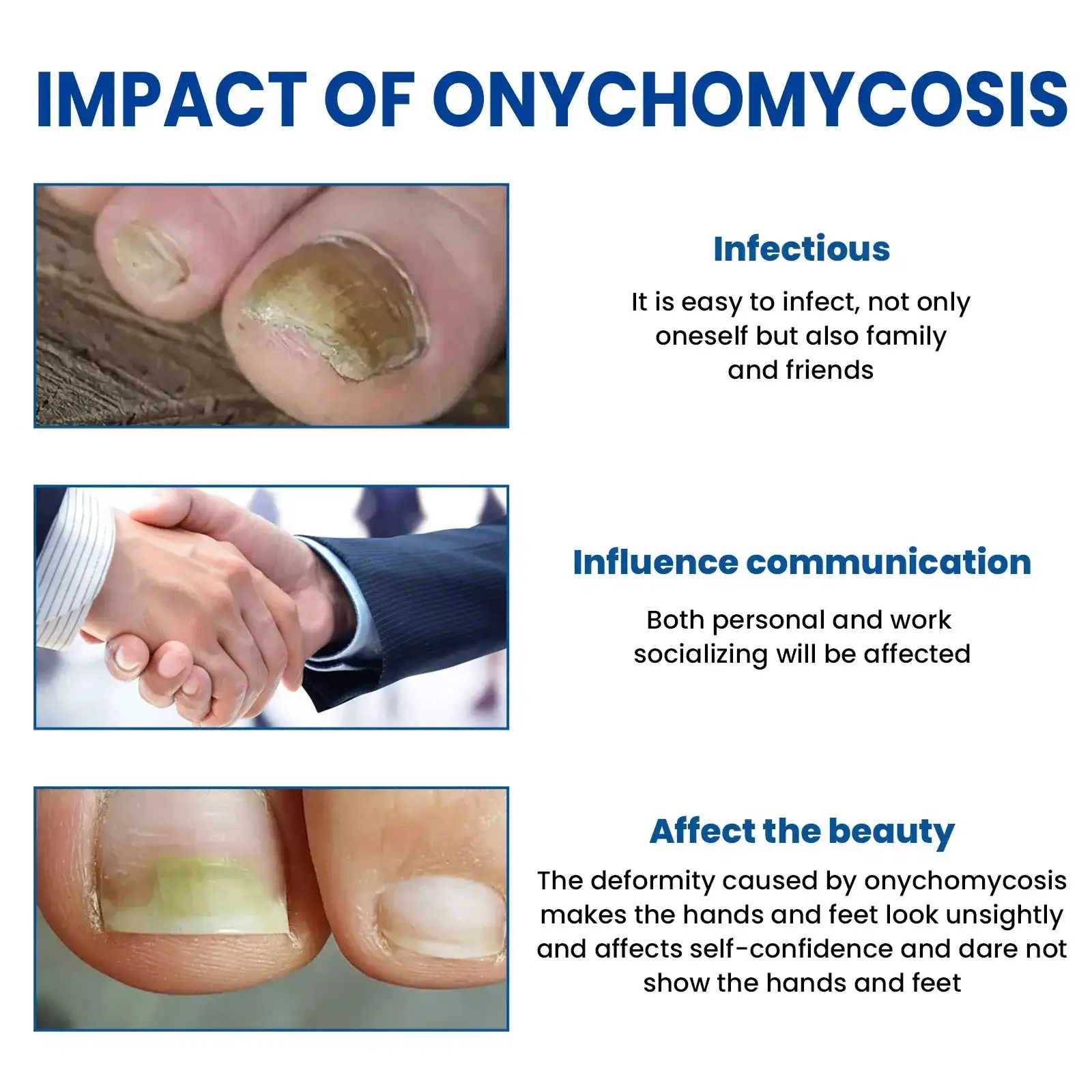 Acezozla® grybelio nagų taisymo pleistrai - Image 2