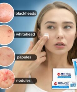 AcneClear dėmių šalinimo kremas