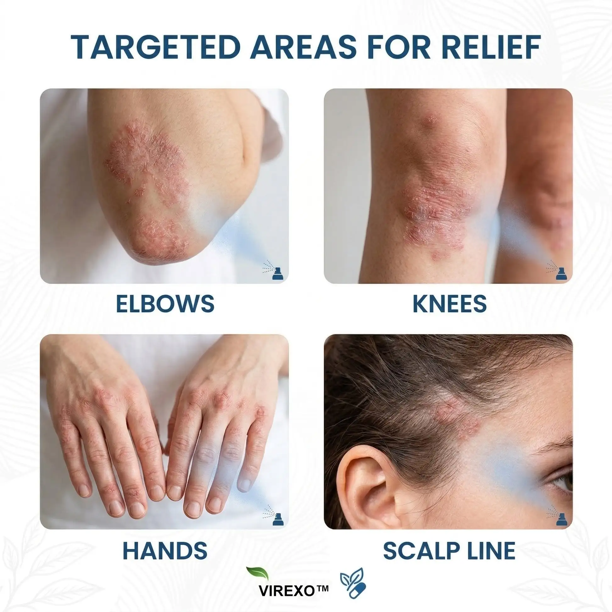 Virexo™ magnio botaninis purškalas - Image 2