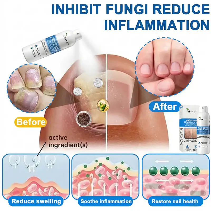 Virexo™ magnio botaninis purškalas - Image 4