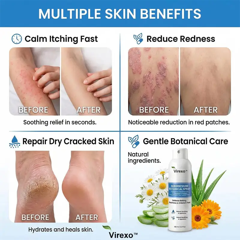 Virexo™ magnio botaninis purškalas - Image 9