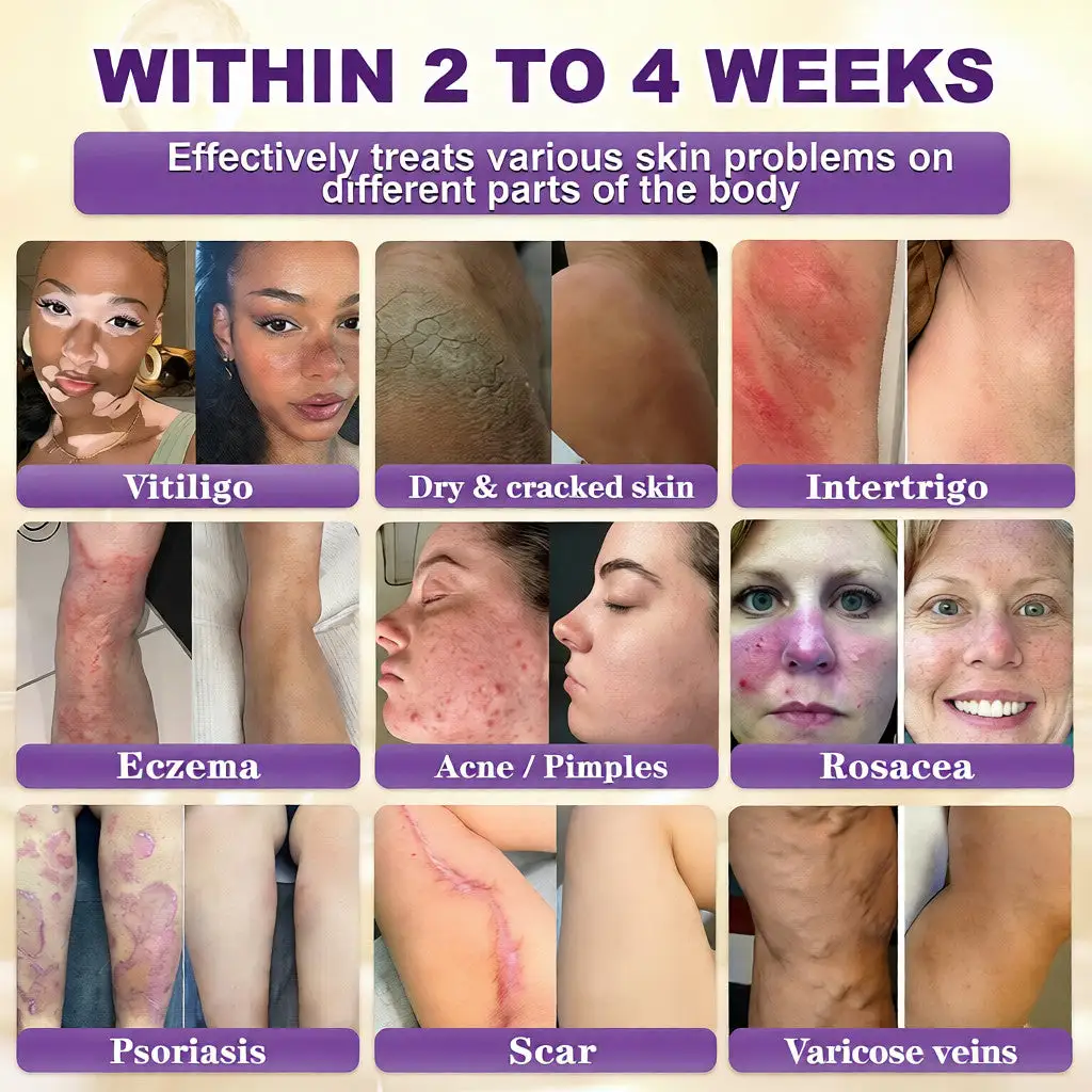 WIMAID® Biotin 10-in-1 odos atstatomasis kremas - Image 2