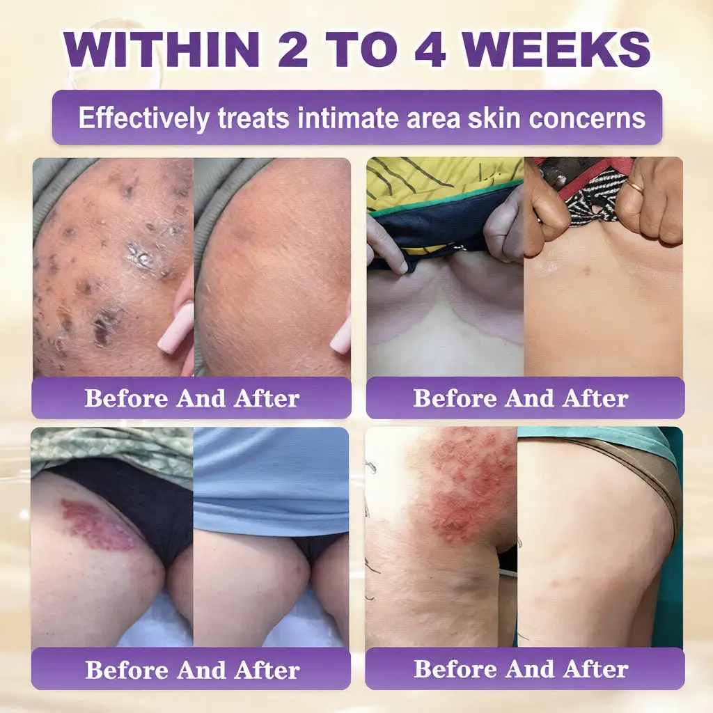 WIMAID® Biotin 10-in-1 odos atstatomasis kremas - Image 4