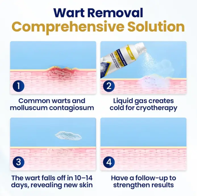 Yagoo® Chillique Bump Renewal Purškalas - Image 3