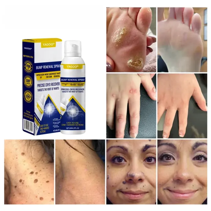 Yagoo® Chillique Bump Renewal Purškalas - Image 5